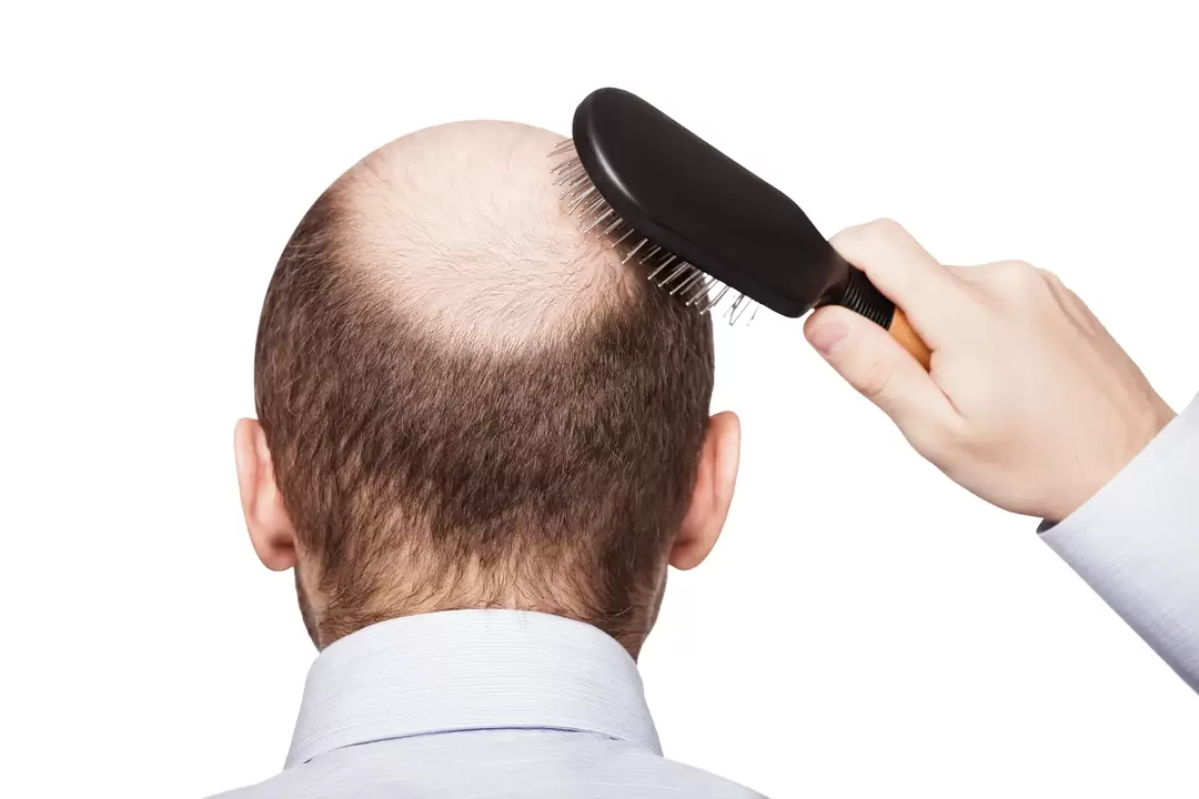 Boldness and treatment with a Verdexedil spray